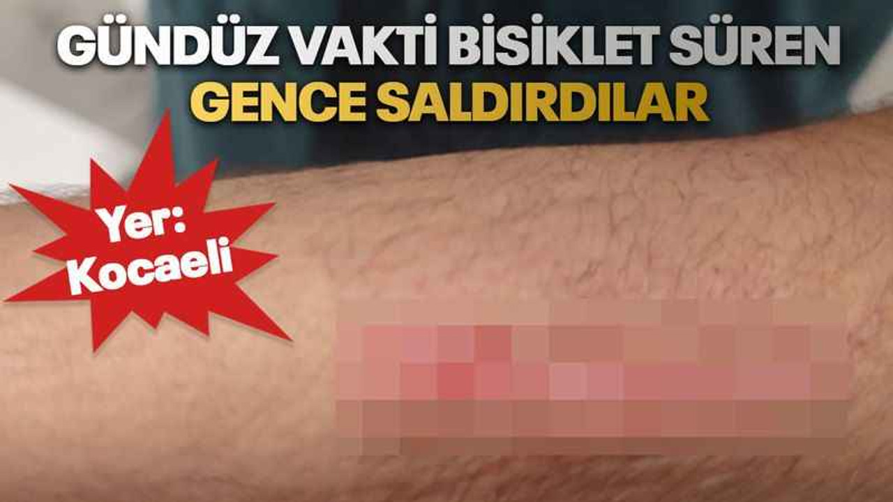 Gündüz vakti bisiklet süren gence saldırdılar